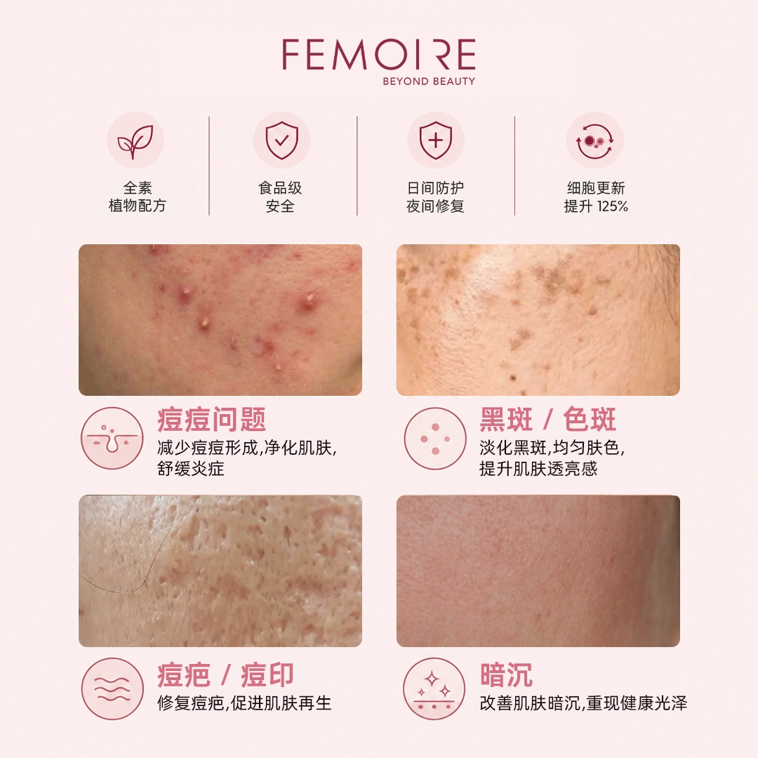 Femoire Day & Night