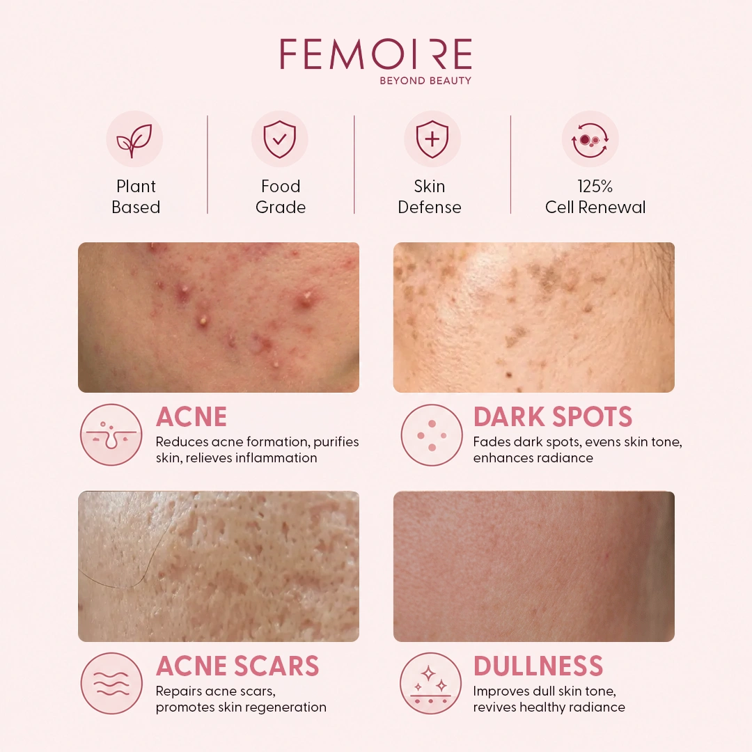 Femoire Day & Night
